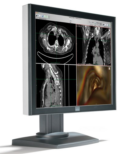 Barco MDRC-2120 Clinical Review Display