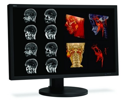 NEC MultiSync MD Series Displays for Medical Professionals