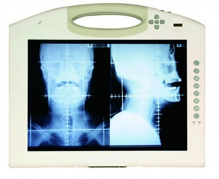 Arbor M1255 Medical Tablet PC